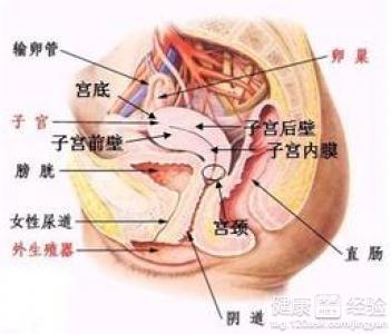 盆腔淤血症最新治疗法,盆腔淤血症最新治疗法研究与应用