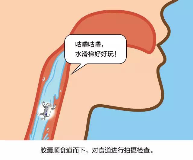 最新胃镜检查不插管多少钱,最新胃镜检查不插管多少钱，了解价格与技术的革新